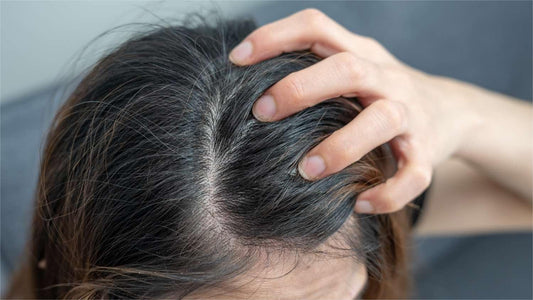 5 Good Habits to Keep Your Scalp Healthy